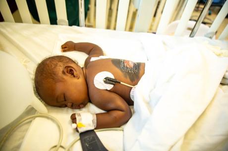 Baby Nybol Wak Wol was among the babies that received treatment at CURE Uganda Children's Hospital 